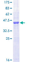 12.5% SDS-PAGE Stained with Coomassie Blue.